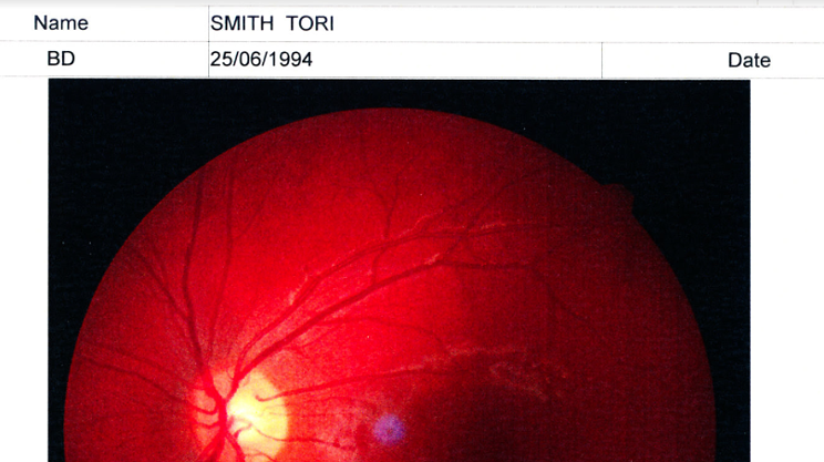 Image: Eye Phenomenons