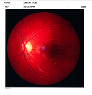 Image: Eye Phenomenons