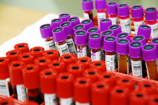 Checked out: AIDS testing in Nova Scotia falls behind
